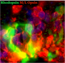 Heatmap image of a retina