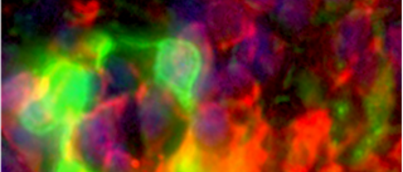 Heatmap image of a retina