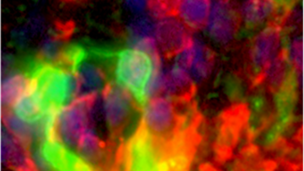 Heatmap image of a retina